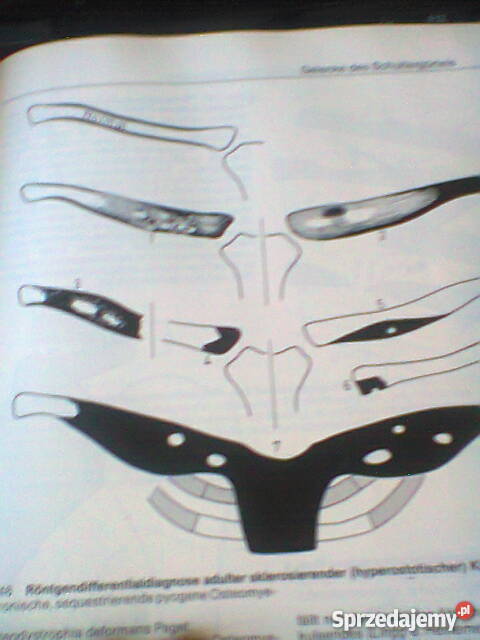 Gelenke Wirbelverbindungen Szczecin