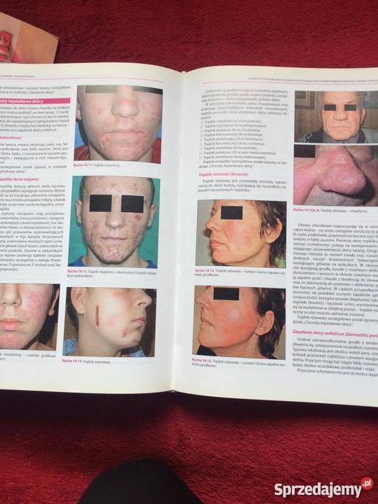 Dermatologia kosmetologów Rok wydania 2011 lubuskie