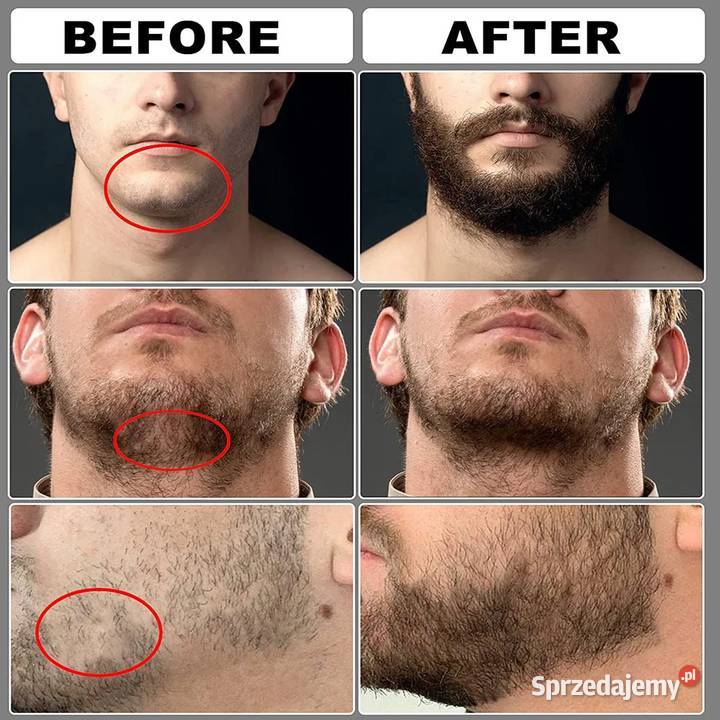 Zestaw na porost brody 5 sztuk Beard Care Unisex Pozostałe mazowieckie