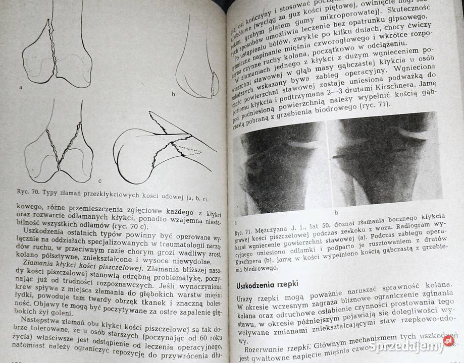 Niepowodzenia w leczeniu uszkodzeń narządów Chełm