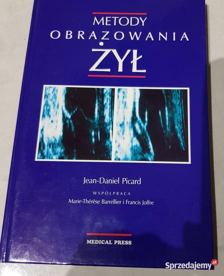 metody obrazowania żył medycyna diagnostyka sprzedam