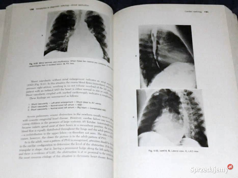 Introduction to Clinical Radiology Richard Rok wydania 1978