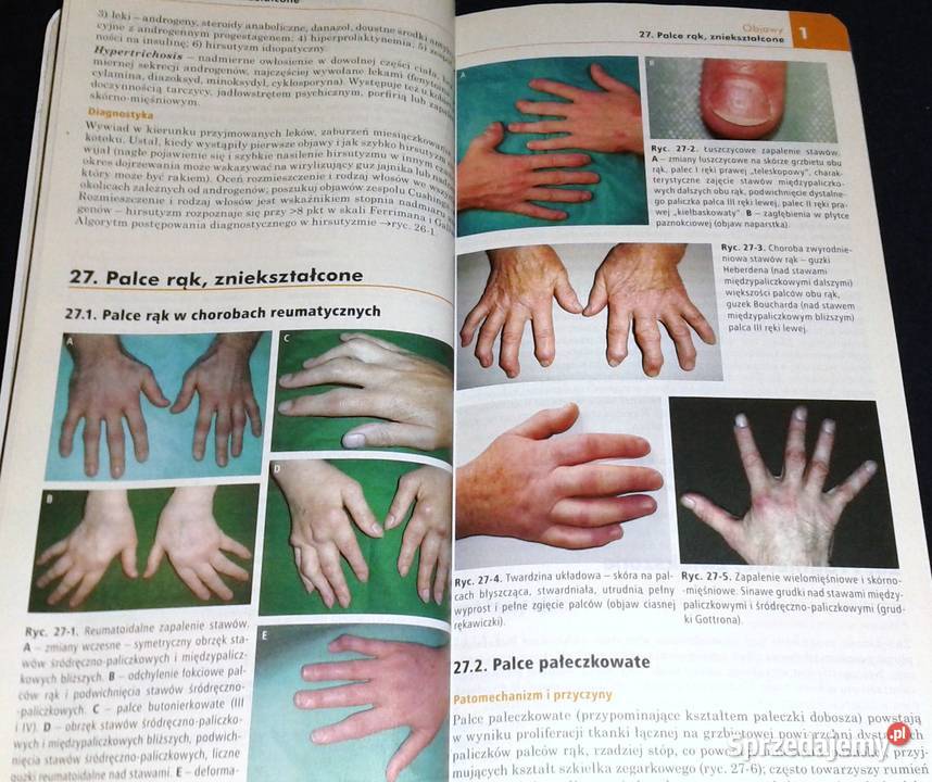 Choroby wewnętrzne Andrzej Szczeklik Piotr Chełm