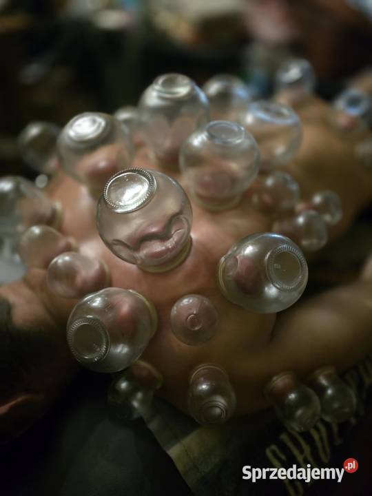 Mobilny masażysta klasyk bańki ogniowe próżniowe Warszawa