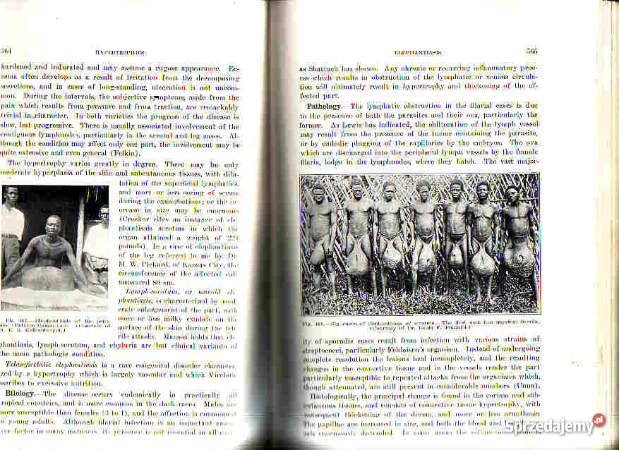 390 DISEASES OF THE SKIN SUTTON THE C V MOSBY CO Książki naukowe i popularnonaukowe małopolskie Czyrna