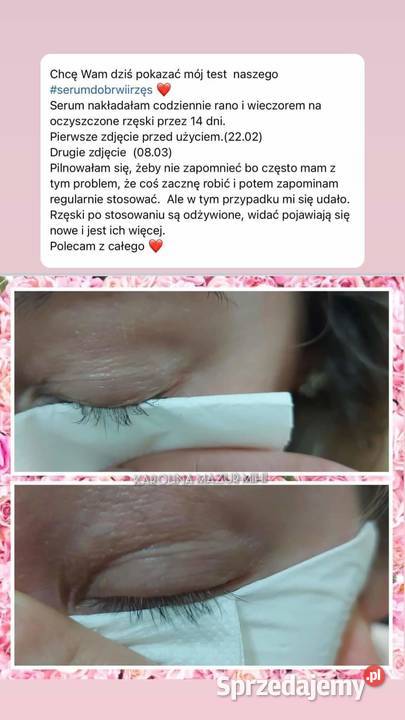 Serum do rzęs i brwi Bez Sterydów Nie uzależnia Hajnówka sprzedam