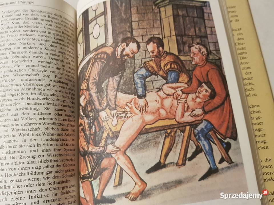 Alte Chirurgie Legende Wirklichkeit Detlef Rster Kielce