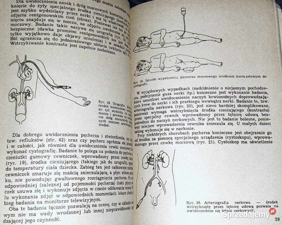Choroby nerek u dzieci Teresa Wyszyńska miękka Chełm