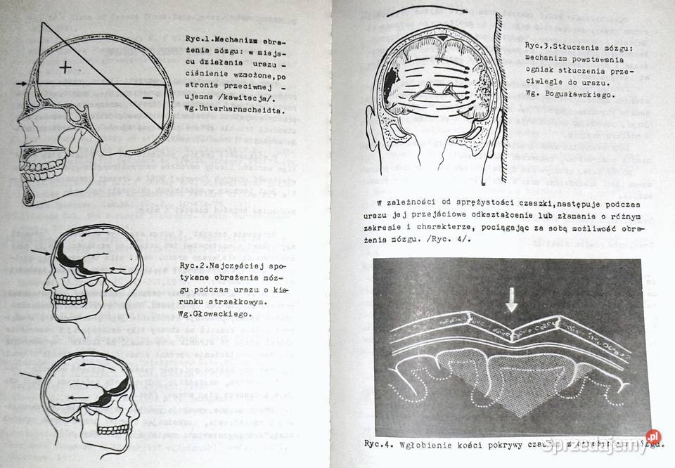 Urazy i obrażenia wielonarządowe Cz 1 A Kawalski sprzedam