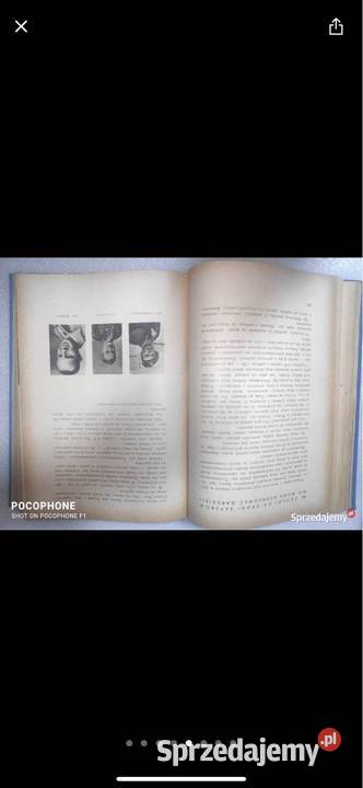 Monte Cassino Gliwice