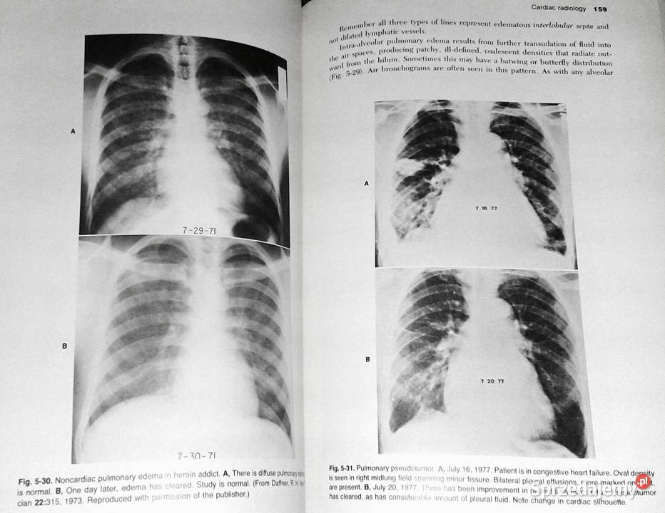 Introduction to Clinical Radiology Richard Pozostałe Chełm