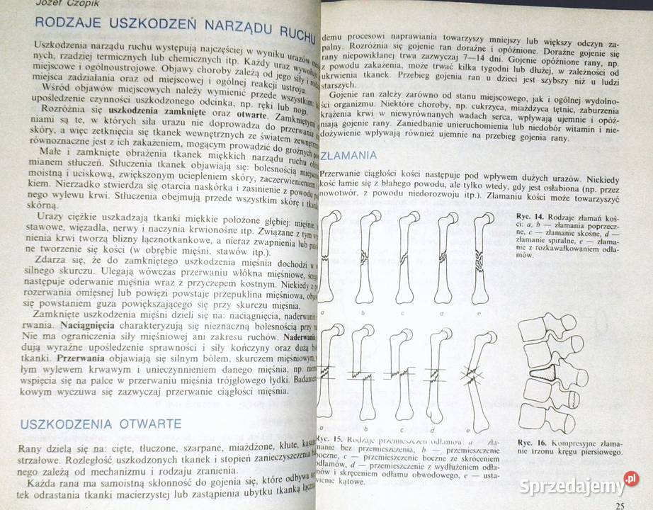 Ćwiczenia usprawniajace w uszkodzeniach kości i Pozostałe Chełm