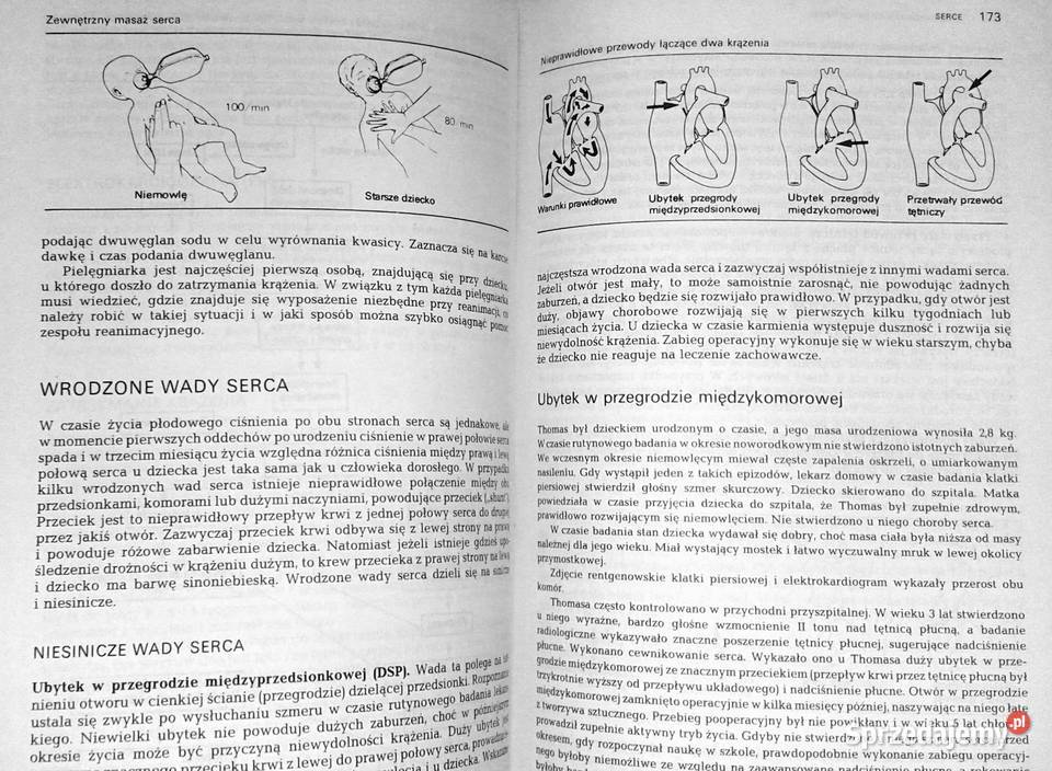 Pielęgnowanie chorych dzieci E Fenella St J Chełm