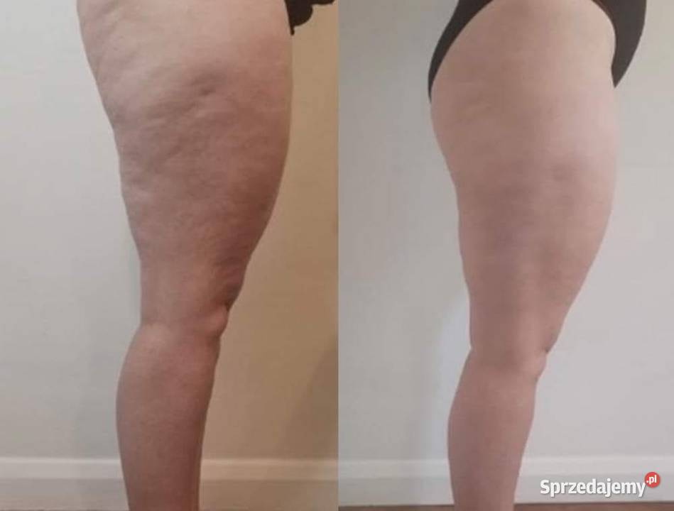 Termokrem ujędrniający Skuteczna pielęgnacja Dla kobiet Hajnówka