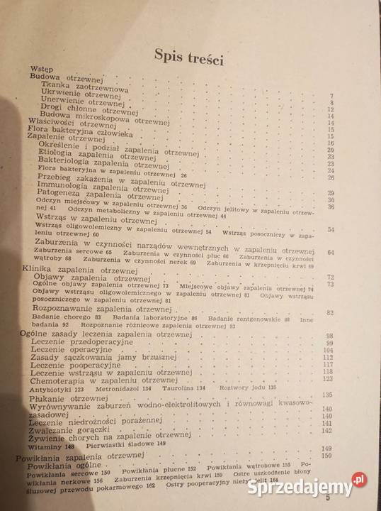 Zapalenie otrzewnej Leszek Ciesielski medycyna Kielce