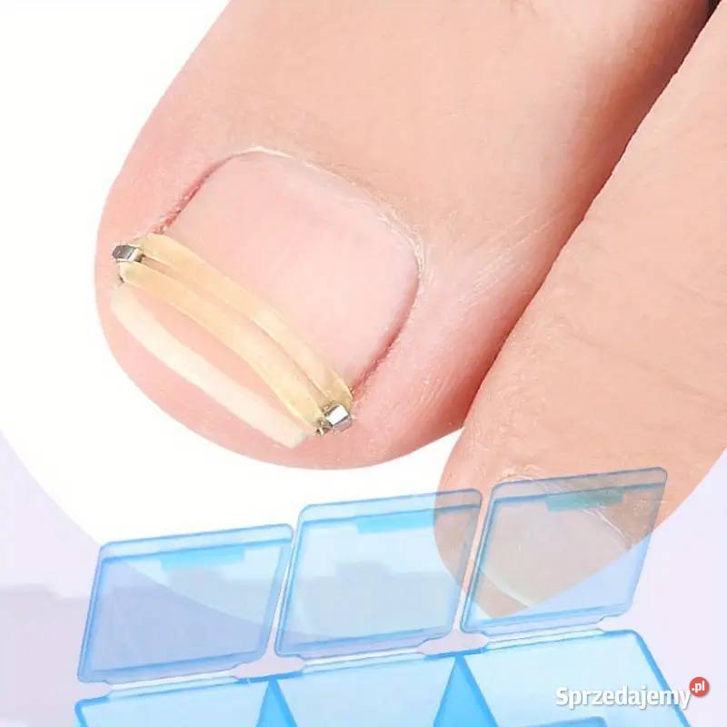 Wrastające Paznokcie Zestaw Korekcyjny AS Płock