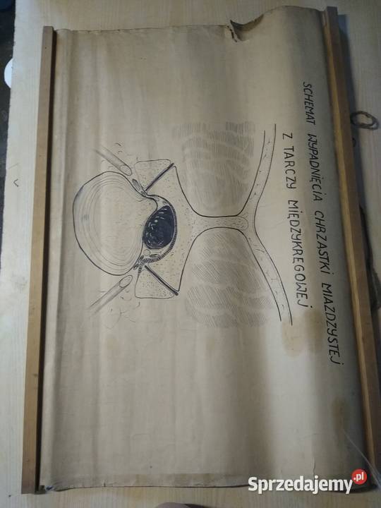 plakat o schemacie wypadnięcia chrząstki Warszawa sprzedam