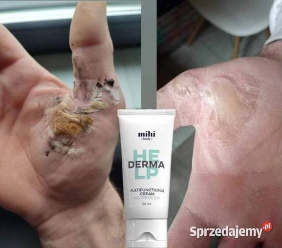 Krem NO PROBLEM Łuszczyca AZS Sucha skóra podlaskie