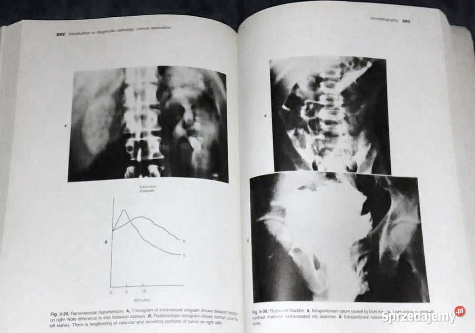Introduction to Clinical Radiology Richard Chełm