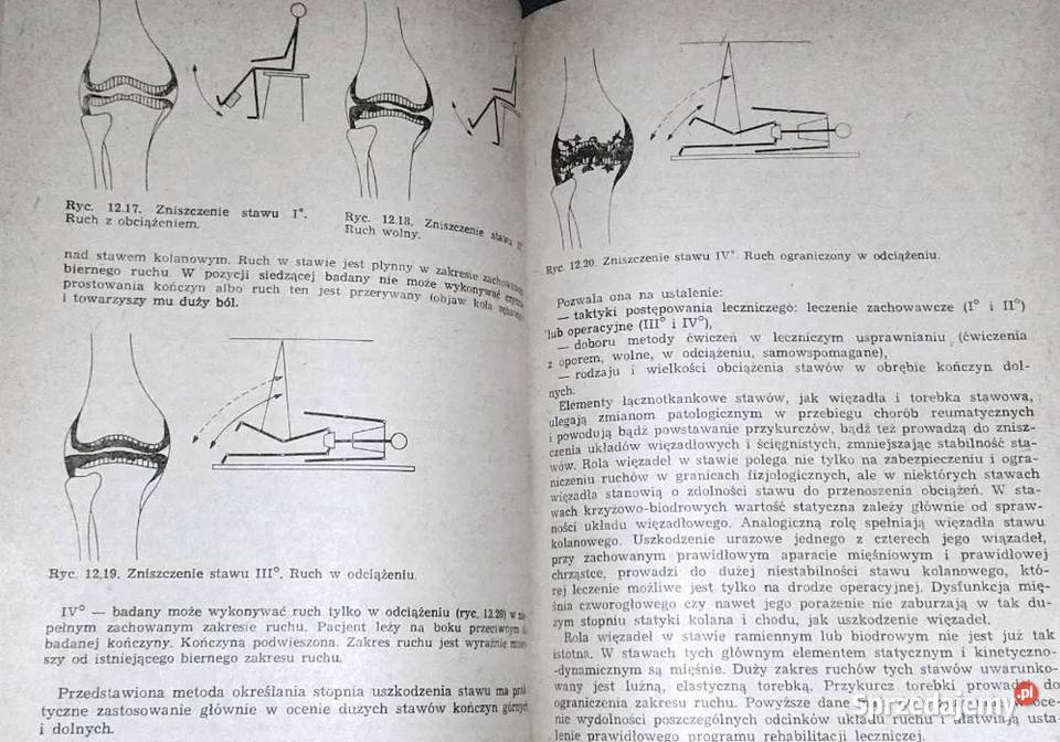 Zarys reumatologii Red Włodzimierz Bruhl Rok wydania 1987 Chełm sprzedam