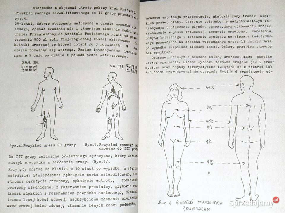 Urazy i obrażenia wielonarządowe Cz 1 A Kawalski Rok wydania 1986 Pozostałe