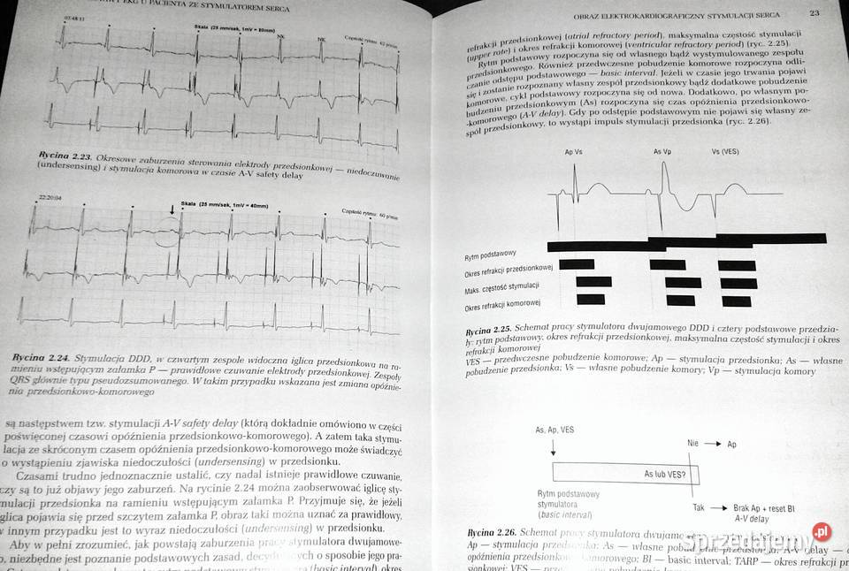 Podstawy EKG u pacjentów ze stymulatorem serca F lubelskie
