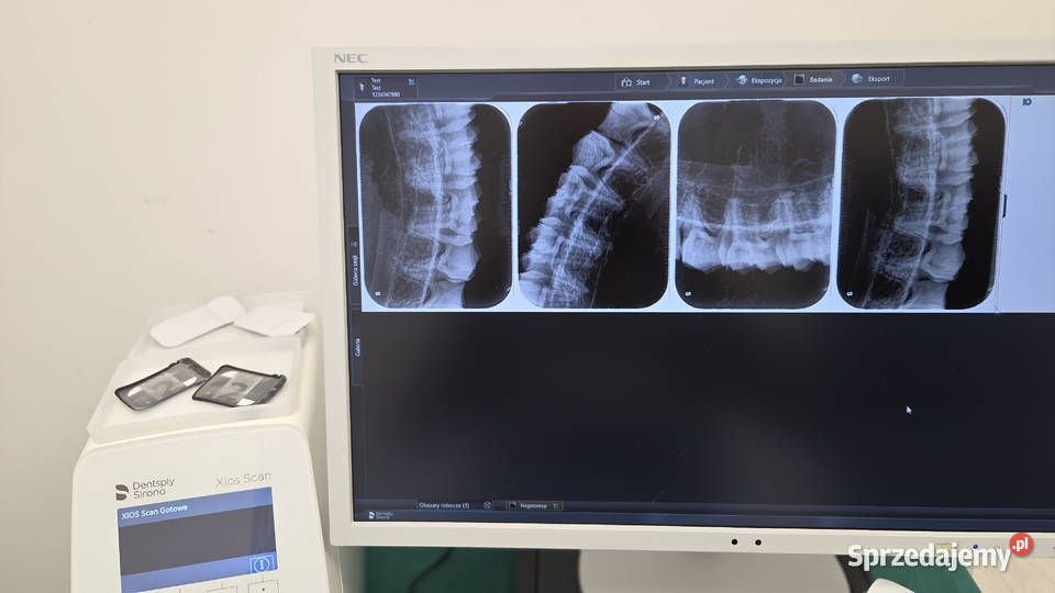 Skaner płytek obrazowych RTG Sirona Dentsply Wrocław