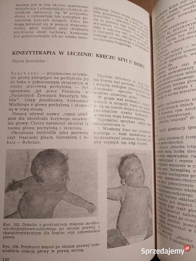 Fizjoterapia Weissa Łódź