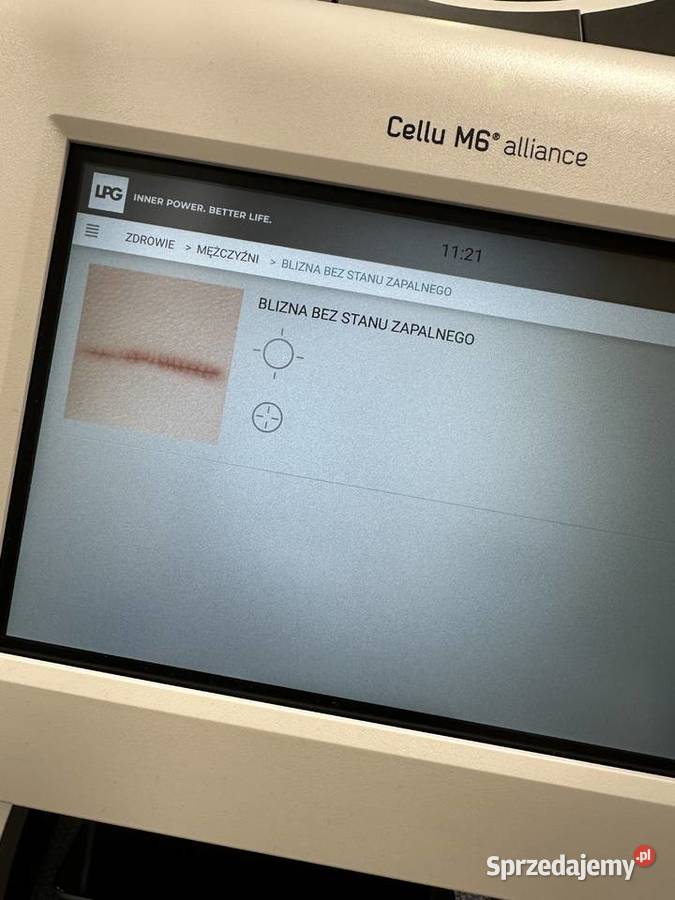 LPG Alliance endermologia NISKI PRZEBIEG Bydgoszcz