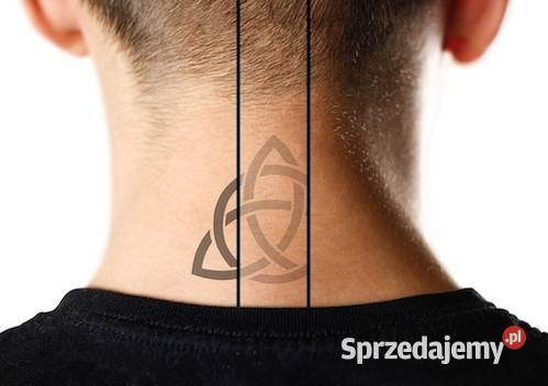 Laser do usuwania pigmentów ND YAG Q switch Gdańsk sprzedam
