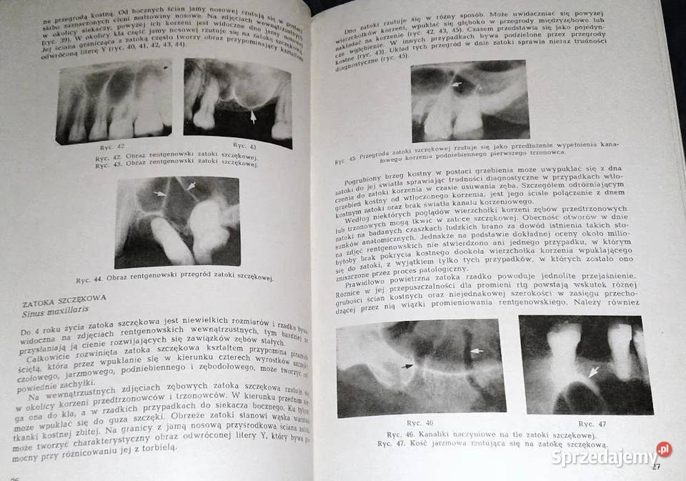 Zarys rentgenodiagnostyki stomatologicznej Z Chełm