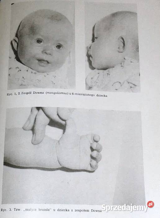 Choroby układu nerwowego dzieci i młodziezy J Pozostałe lubelskie