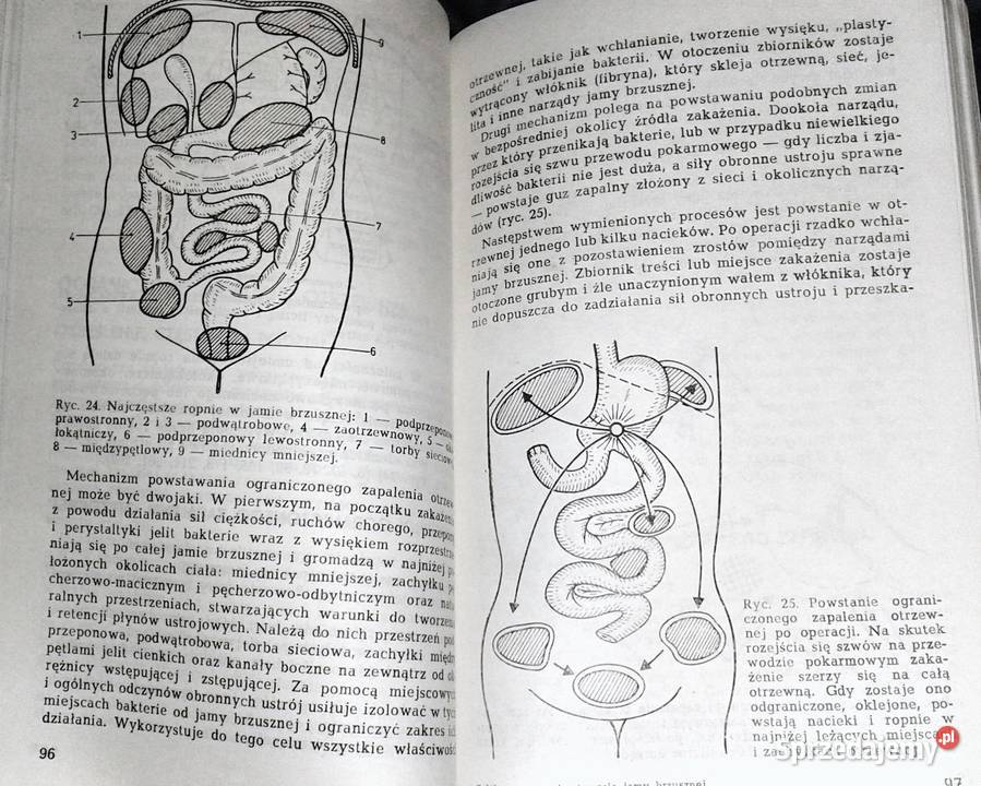 Wczesne powtórne otwarcie jamy brzusznej Leszek Chełm