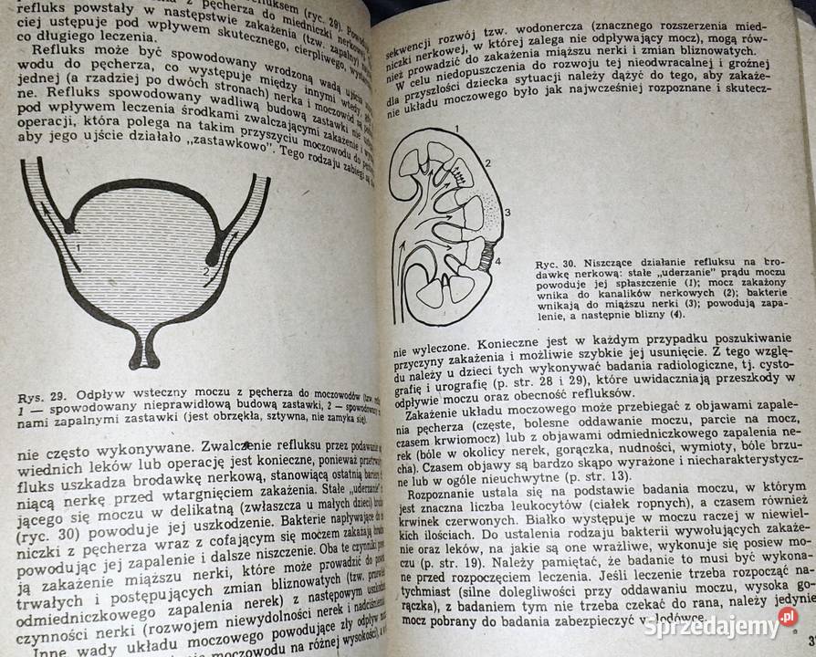 Choroby nerek u dzieci Teresa Wyszyńska Pozostałe Książki i Podręczniki Chełm