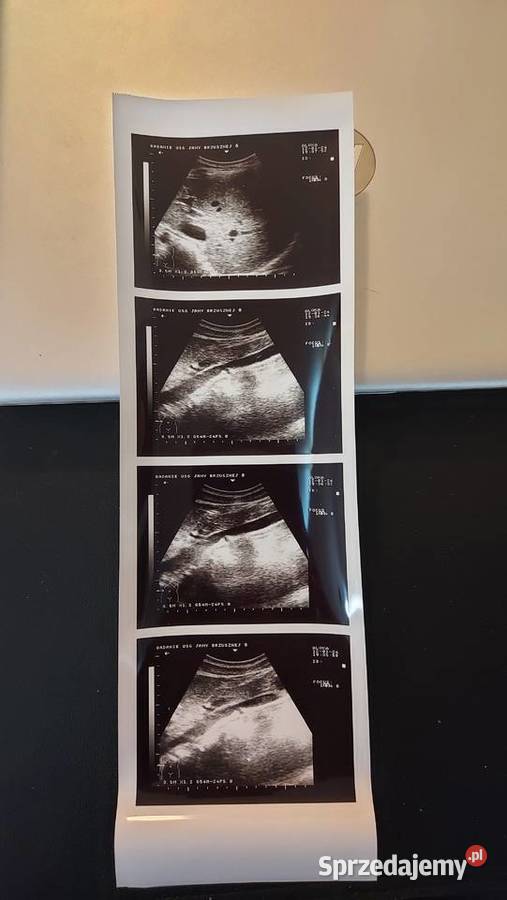 Aparat ultrasonograficzny USG drukarka głowice Wyposażenie szpitali i gabinetów Radom sprzedam
