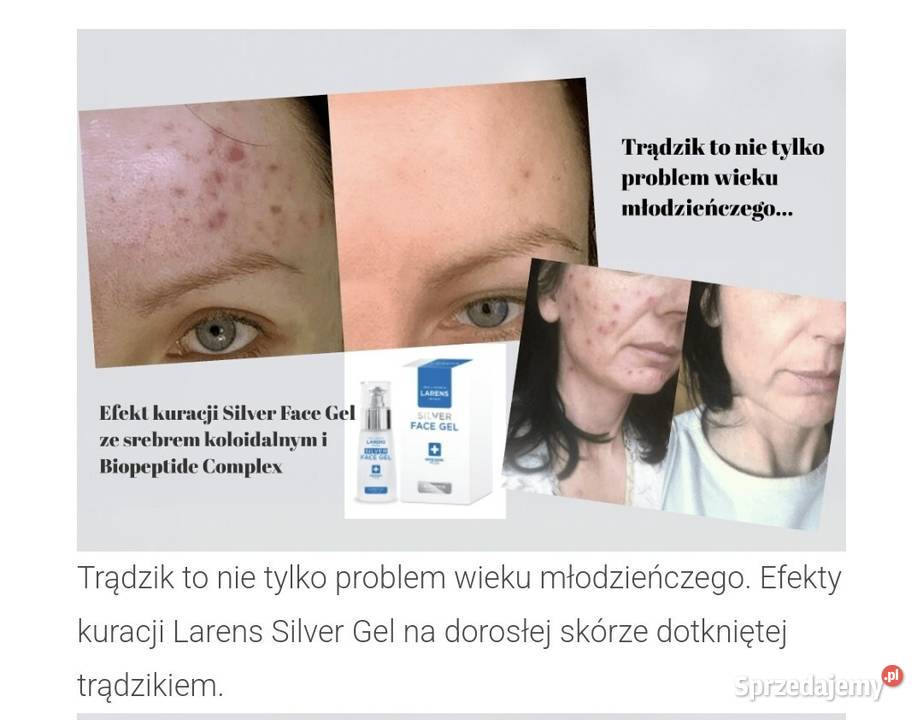 LARENS Silver gel Skóra problematyczna 50 ml Kosmetyki Działdowo sprzedam