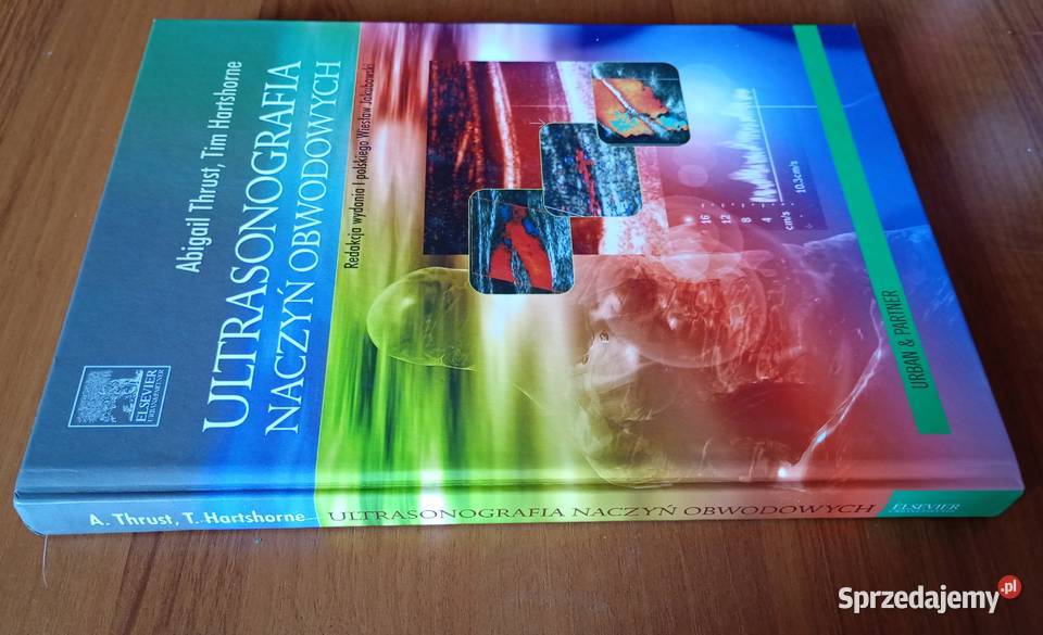 Ultrasonografia naczyń obwodowych Abigail Thrush Gdańsk