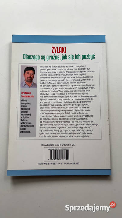 ŻYLAKI Dlaczego są groźne się ich pozbyć mazowieckie Warszawa sprzedam