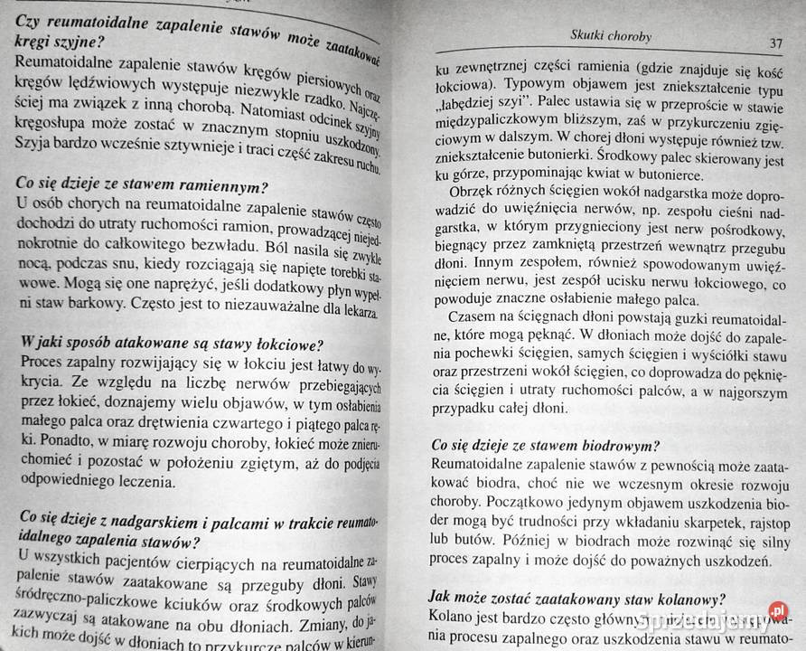 Reumatyzm Robert G Lahita Chełm sprzedam