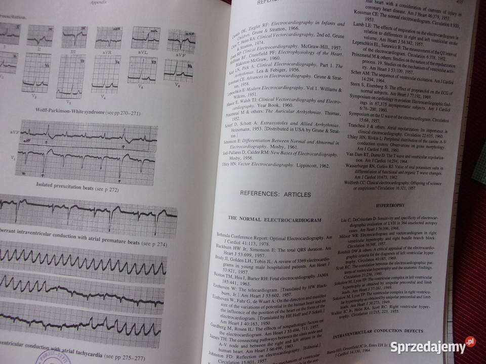 Zasady Elektrokardiografia kliniczna Wydanie 10 Warszawa