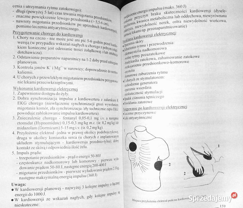 Ostre stany kardiologiczne Algorytmy Chełm