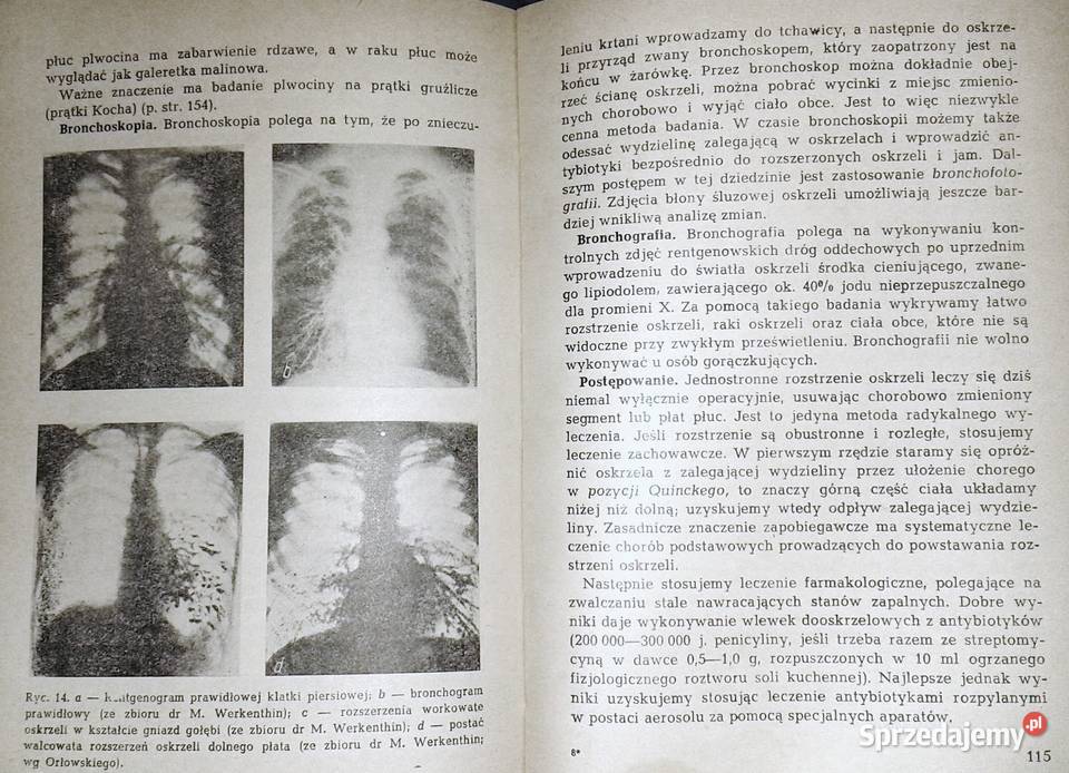 Zarys chorób wewnętrznych W Musiał H Pracka Chełm