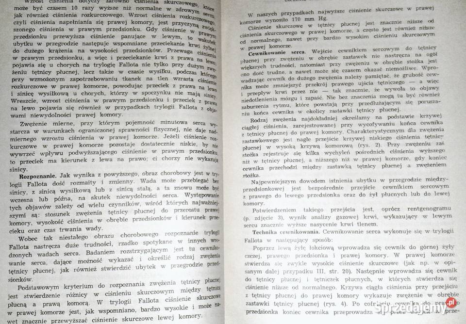 Leczenie operacyjne trylogii Fallota W Bross Chełm