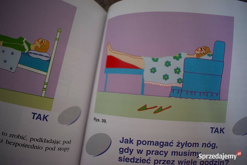 Żylaki leczenie profilaktyka przyczyny objawy Chełmno sprzedam