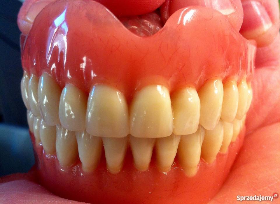 PROTEZA PROTEZY ZEBY pacjenta WARSZAWA