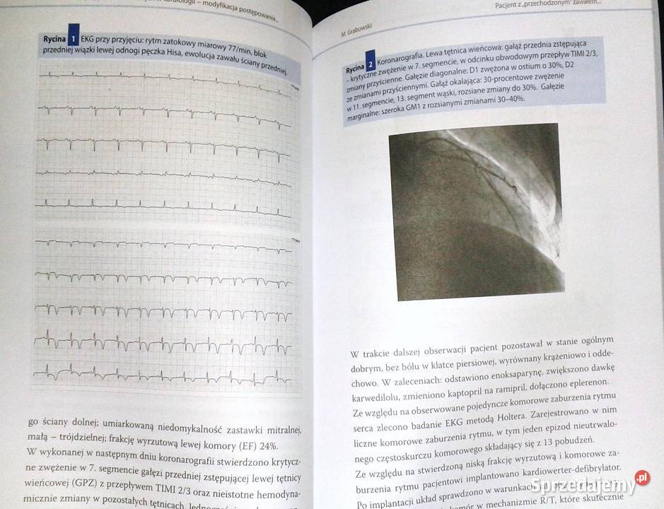 Komentarze do przypadków klinicznych w Chełm