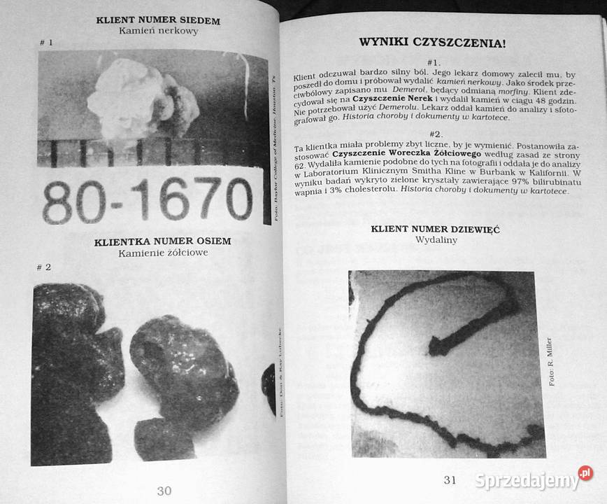 Czyszczenie okrężnicy Jennifer Weiss Chełm