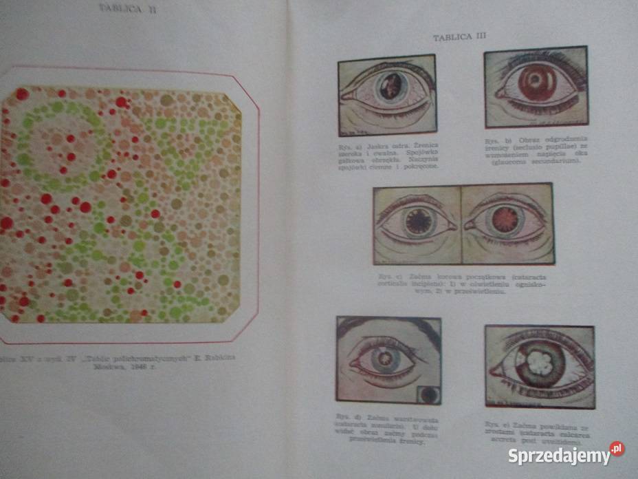 Okulistyka medycyna chirurgia interna biochemia medycyna, nauki medyczne sprzedam