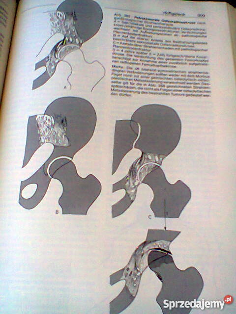 Gelenke Wirbelverbindungen Szczecin sprzedam