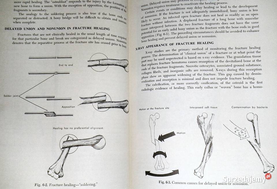 Handbook for the Orthopaedic Assistant FRichard Chełm